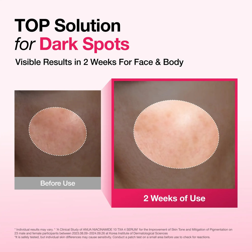 [Anua] Dark Spot Correcting Serum : 10% Niacinamide+ 4% Tranexamic Acid 1.01 fl.oz. (30ml) ｜ Niacinamide Serum, PM Skincare product, Hyperpigmentation, Brightening